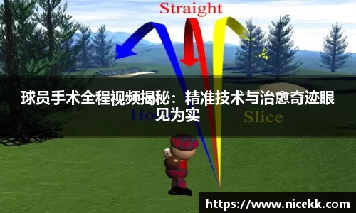 球员手术全程视频揭秘：精准技术与治愈奇迹眼见为实